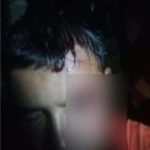 ডুমুরিয়ায় জমি-জমা সংক্রান্ত বিরোধে প্রতিপক্ষের হামলায় আহত ২