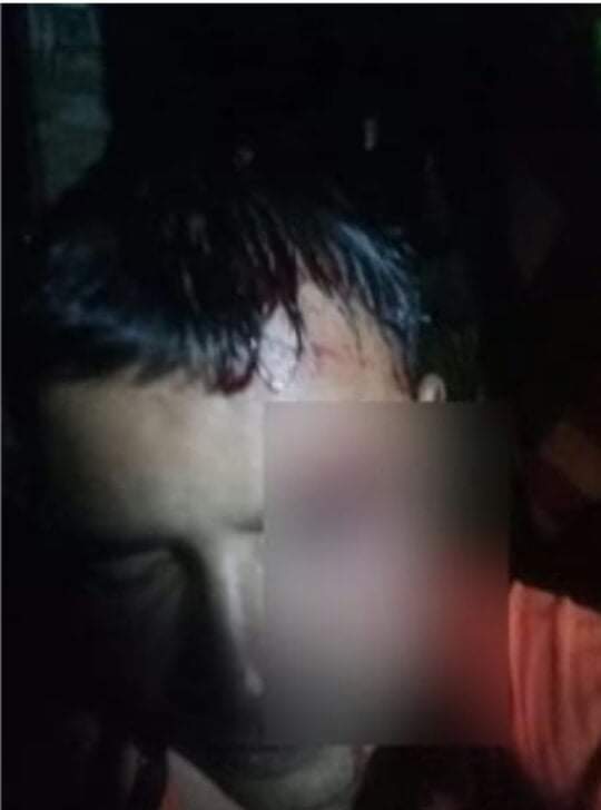 ডুমুরিয়ায় জমি-জমা সংক্রান্ত বিরোধে প্রতিপক্ষের হামলায় আহত ২