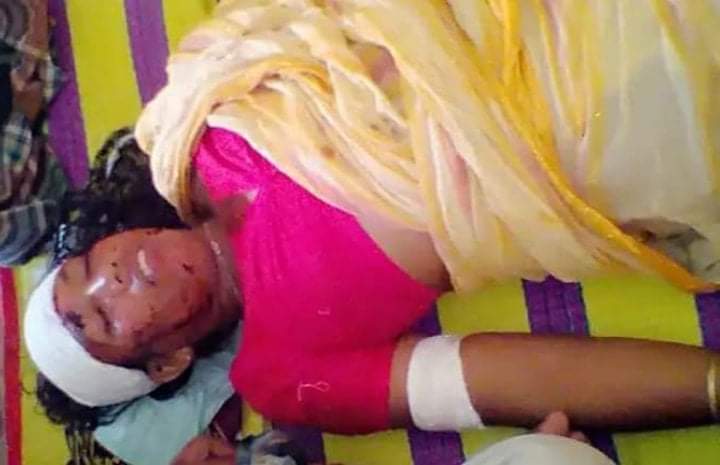 পাইকগাছায় কূপ্রস্তাবে রাজী না হওয়ায় বিধবাকে কুপিয়ে জখম