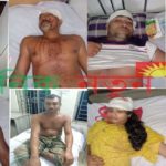 কলারোয়ায় নির্বাচনী সহিংসতায় নৌকা প্রতিকের প্রার্থীসহ আহত ১০
