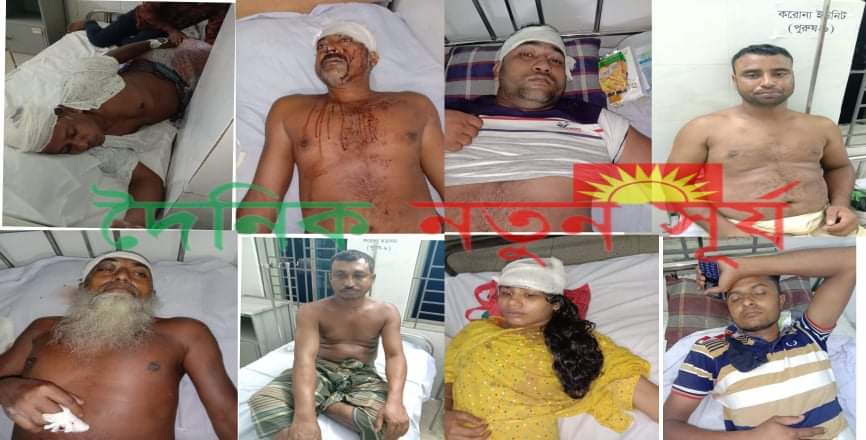 কলারোয়ায় নির্বাচনী সহিংসতায় নৌকা প্রতিকের প্রার্থীসহ আহত ১০