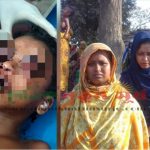মা মরা সন্তানকে মধ্যযুগীয় কায়দায় নির্যাতন করলো পাষণ্ড মামী
