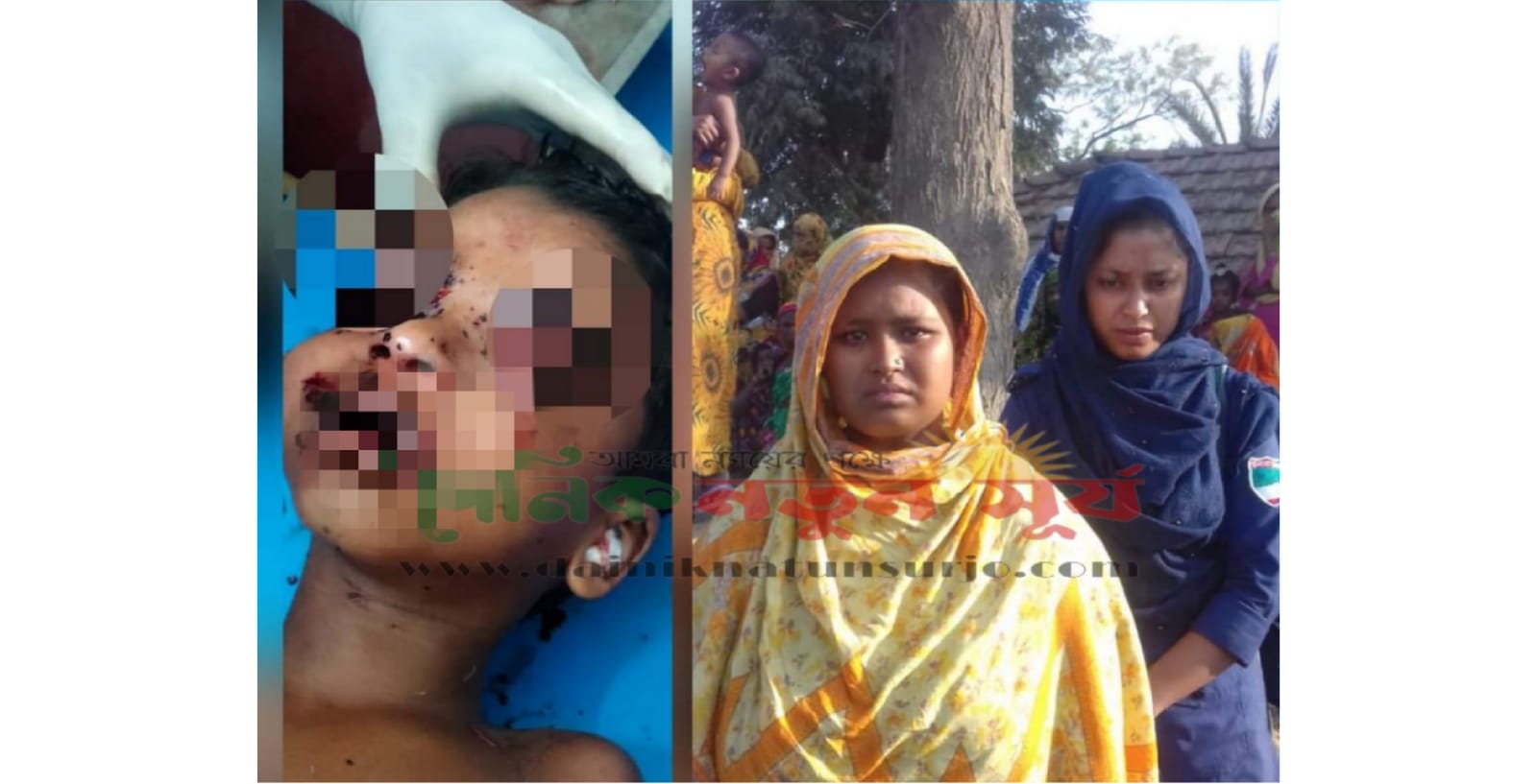 মা মরা সন্তানকে মধ্যযুগীয় কায়দায় নির্যাতন করলো পাষণ্ড মামী