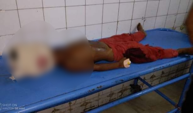 শার্শায় মোটরসাইকেলে কেড়ে নিলো ছয় বছরের শিশুর প্রাণ