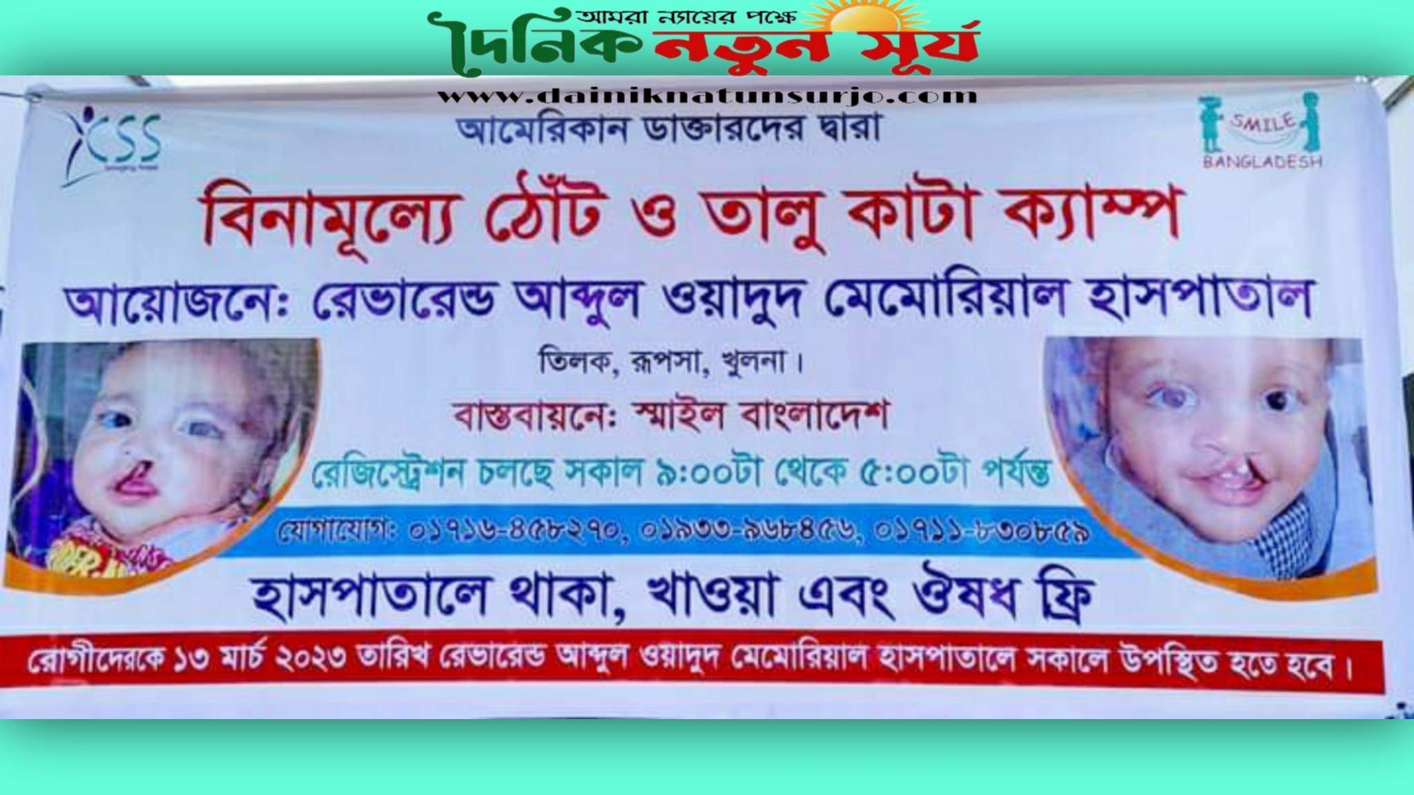 বিনামূল্যে ঠোঁট এবং তালু কাটা অপারেশন