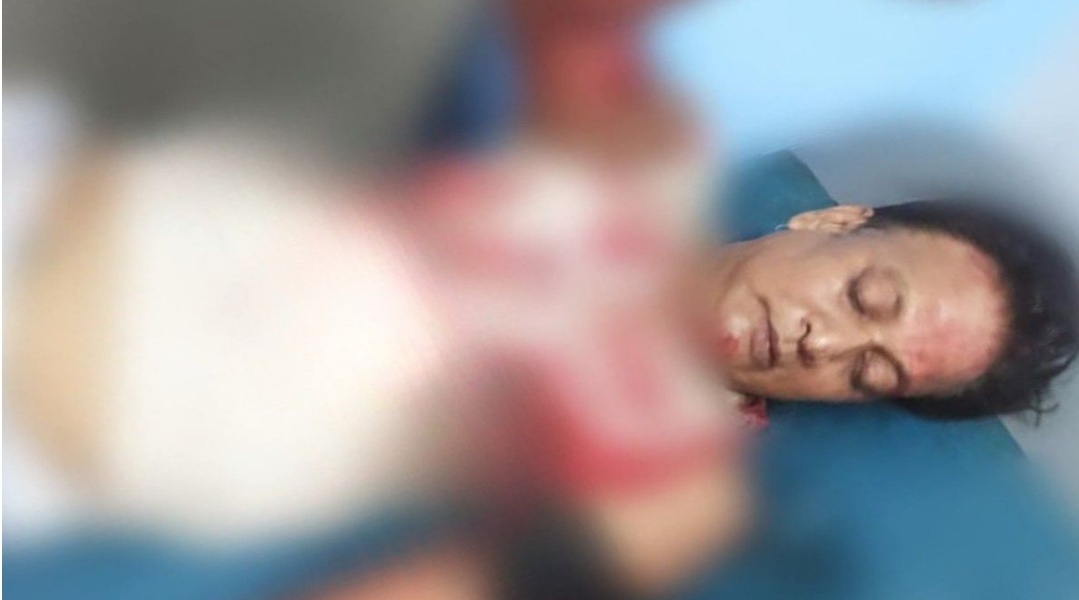 খুলনায় পাওনা টাকা চাওয়ায় এক ব্যক্তি কুপিয়ে জখম
