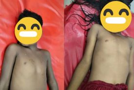 খেলতে গিয়ে পুকুরে ডুবল দুই ভাইবোন 