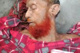 প্রতাপনগরে পুকুরে ডুবে ৮০ বয়সী বৃদ্ধের মৃত্যু