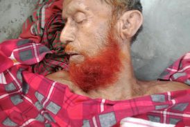 প্রতাপনগরে পুকুরে ডুবে ৮০ বয়সী বৃদ্ধের মৃত্যু